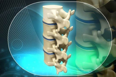 3D Printed Spine Implants